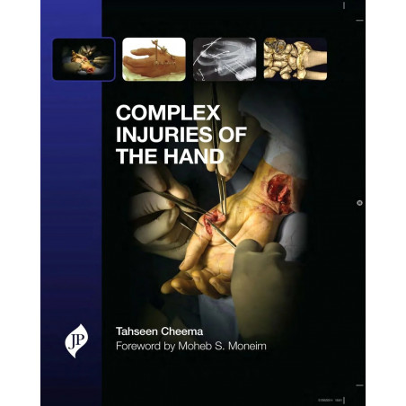 Complex Injuries of The Hand book by Cheema Tahseen