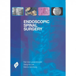 Endoscopic Spinal Surgery book by Lewandrowski