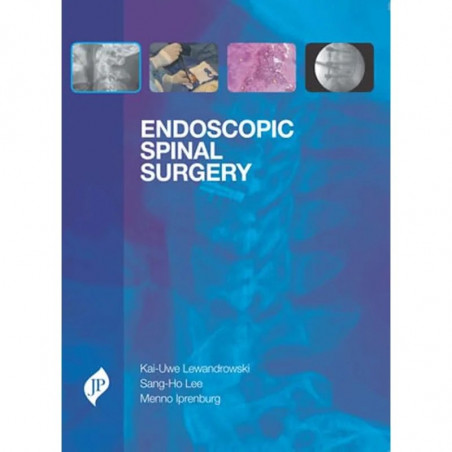 Endoscopic Spinal Surgery book by Lewandrowski