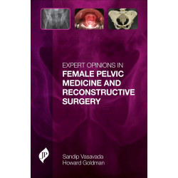 Expert Opinions in Female Pelvic Medicine and Reconstructive Surgery book by Vasavada