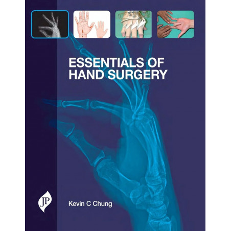 Essentials of Hand Surgery book by Chung Kevin C