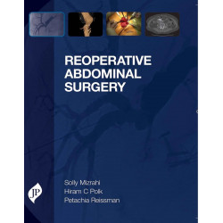 Reoperative Abdominal Surgery book by Mizrahi Solly