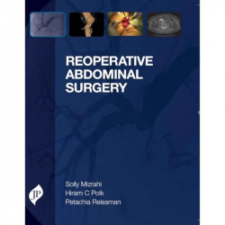 Reoperative Abdominal Surgery book by Mizrahi Solly - Back Cover