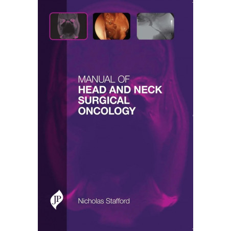 MANUAL OF HEAD AND NECK SURGICAL ONCOLOGY book by Stafford Nocholas