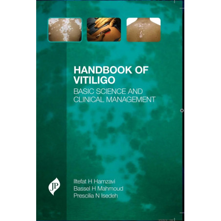 Handbook of Vitiligo book by M.D. Hamzavi, Iltefat H., Ph.D. Mahmoud, Bassel H., M.D.