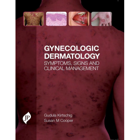 GYNECOLOGIC DERMATOLOGY SYMPTOMS, SIGNS AND CLINICAL MANAGEMENT book by Ph.D. Kirtschig, Gudula, M.D., M.D. Cooper, Susan M.