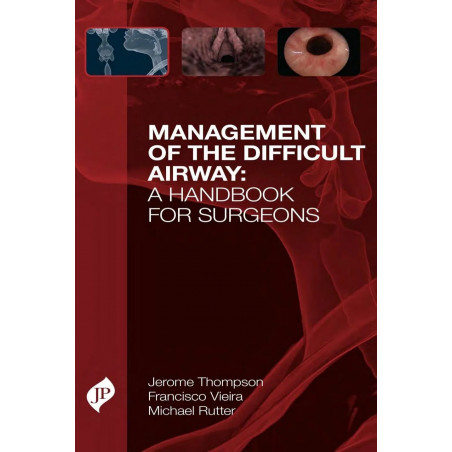 MANAGEMENT OF THE DIFFICULT AIRWAY: A HANDBOOK FOR SURGEONS book by M.D. Thompson, Jerome W., M.D. Vieira, Francisco