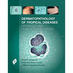 Dermatopathology of Tropical Diseases Pathology and Clinical Correlations book by M.D. Sangueza, Omar P., M.D. Francisco Bra…