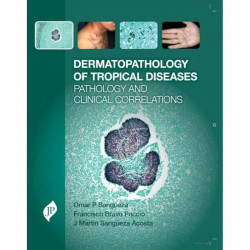 Dermatopathology of Tropical Diseases Pathology and Clinical Correlations book by M.D. Sangueza, Omar P., M.D. Francisco Bra… -