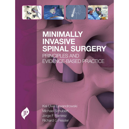 Minimally Invasive Spinal Surgery book by M.D. Lewandrowski, Kai-Uwe, M.D. Schubert, Michael D.