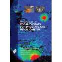 Handbook of Focal Therapy for Prostate and Renal Cancer book by Truls Bjerklund Johansen, Damian Greene