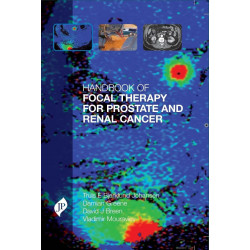 Handbook of Focal Therapy for Prostate and Renal Cancer book by Truls Bjerklund Johansen, Damian Greene