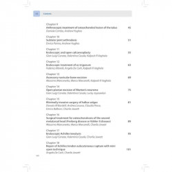EFOST Surgical Techniques in Sports Medicine - Foot and Ankle Surgery book by Canata Glan Lulgi - Additional Image 8