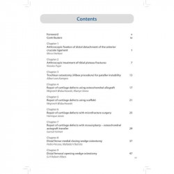 SURGICAL TECHNIQUES IN SPORTS MEDICINE KNEE SURGERY VOLUME 2 :BONE AND CARTILAGE book by Henrique Jones, Burt Klos - Additional