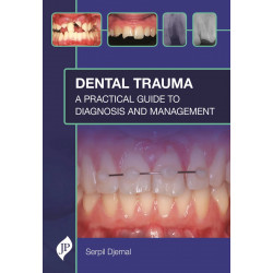 DENTAL TRAUMA: A PRACTICAL GUIDE TO DIAGNOSIS AND MANAGEMENT book by Serpil Djemal