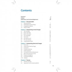 NEUROIMAGING POCKET TUTOR book by Rory Piper - Additional Image 4