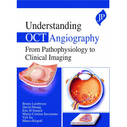 UNDERSTANDING OCT ANGIOGRAPHY FROM PATHOPHYSIOLOGY TO CLINICAL IMAGING book by et al Bruno Lumbroso