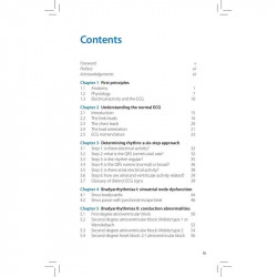 ECG INTERPRETATION POCKET TUTOR book by Simon James, Katherine Nelson - Additional Image 5