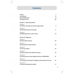 MICROINVASIVE DENTISTRY: CLINICAL STRATEGIES AND TOOLS book by John J Graeber - Additional Image 5