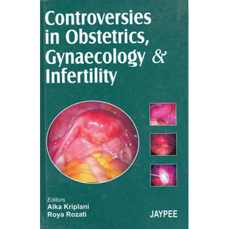 Controversies in Obstetrics, Gynaecology and Infertility book by Kriplani