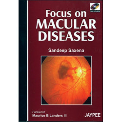 Focus on Macular Diseases with DVD-ROM book by Saxena