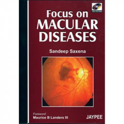 Focus on Macular Diseases with DVD-ROM book by Saxena - Back Cover