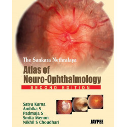 The Sankara Nethralaya Atlas of Neuro-ophthalmology (POD) book by Karna