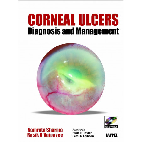 Corneal Ulcer Diagnosis and Management with DVD-ROM book by Sharma