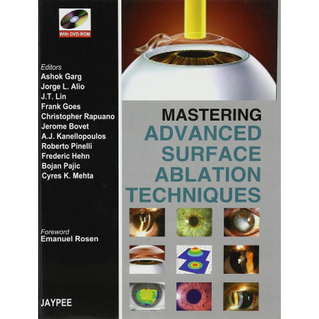 MASTERING ADVANCED SURFACE ABLATION TECHNIQUES WITH DVD-ROM book