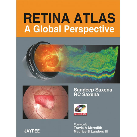Retina Atlas: A Global Perspective with DVD-ROM (POD) book by Saxena