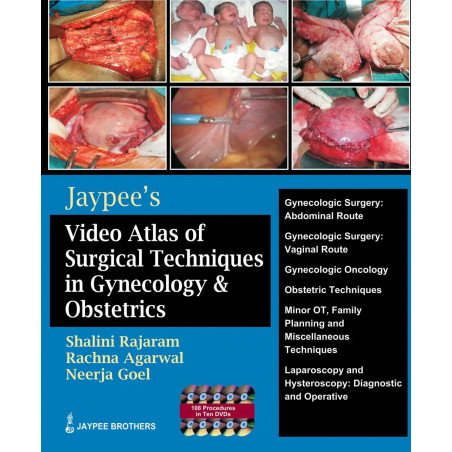 Jaypee’s Video Atlas of Surgical Techniques in Gynecology & Obstetrics with 10 DVD-ROMs book by Nagrath