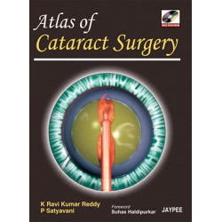 Atlas of Cataract Surgery with DVD-ROM book by Kumar Reddy