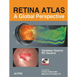 Retina Atlas: A Global Perspective with DVD-ROM (POD) book by Saxena - Back Cover