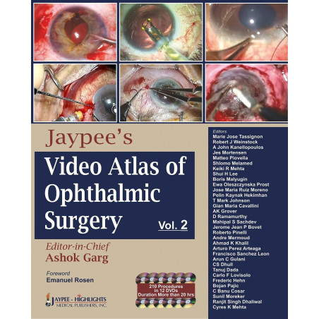 Jaypee'S Video Atlas Of Ophthalmic Surgery Vol.2 With 12 Dvd Roms: Volume II book by Garg