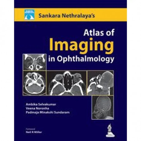 Sankara Nethralaya Atlas of Imaging in Ophthalmology book by Padmaja Minakshi Sundaram Ambika Selvakumar, Veena Noronha