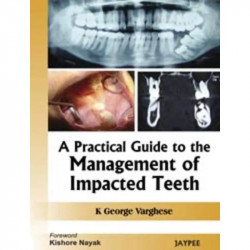 A Practical Guide to the Management of Impacted Teeth book by George Varghese
