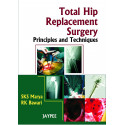 Total Hip Replacement Surgery: Principles and Techniques book by SKS Marya, RK Bawari