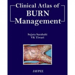 Clinical Atlas of Burn Management book by Sarabahi
