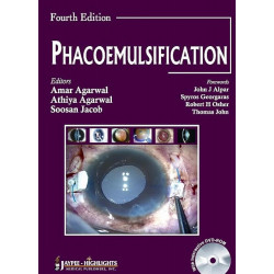 Phacoemulsification book by Agarwal, Amar Agarwal