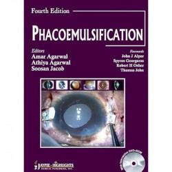 Phacoemulsification book by Agarwal, Amar Agarwal - Back Cover