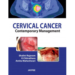 Cervical Cancer: Contemporary Management book by Shalini Rajaram, K Chitrathara
