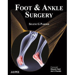 FOOT & ANKLE SURGERY book by Parekh