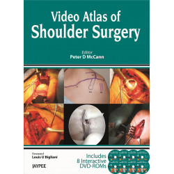 Video Atlas Of Shoulder Surgery Book With Slip Case Includes 8 Interative Dvd-Roms (DVDs) book by Mccann