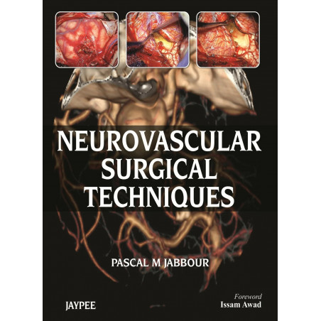 Neurovascular Surgical Techniques book by Jabbour