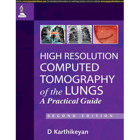 High Resolution Computed Tomography of the Lungs: A Practical Guide book by Karthikeyan