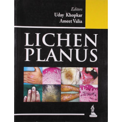 Lichen planus book by Uday Khopkar