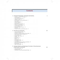 High Resolution Computed Tomography of the Lungs: A Practical Guide book by Karthikeyan - Additional Image 6