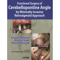 FUNCTIONAL SURGERY OF CEREBELLOPONTINE ANGLE BY MINIMALLY INVASIVE RETROSIGMOID APPROACH book by Parikh Magnan Jacques