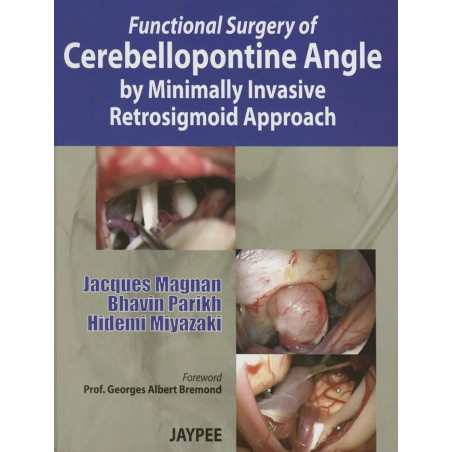 FUNCTIONAL SURGERY OF CEREBELLOPONTINE ANGLE BY MINIMALLY INVASIVE RETROSIGMOID APPROACH book by Parikh Magnan Jacques