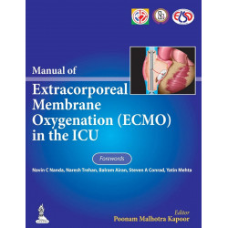 Manual Of Extracorporeal Membrane Oxygenation (Ecmo) In The Icu book by Kapoor Poonam Malhotra